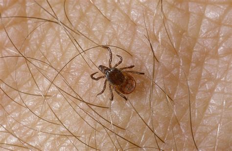 Which Disease Can You Catch From A Tick Bite Lyme Disease Symptoms