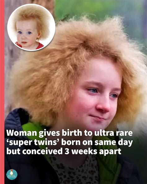 Young Girl Learns To Love Her Uncombable Hair Syndrome