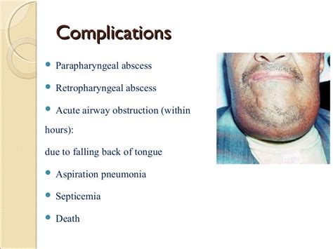 Deep Neck Infection