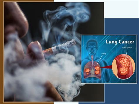 can tobacco cause lung cancer oncologist explains risk factors symptoms and prevention tips