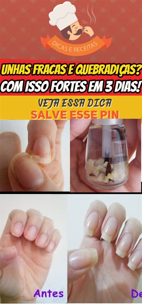 Como Fortalecer As Unhas Fracas E Quebradi As Em Dias Unhas Fracas