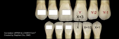 Simplifying Optimal Tooth Size Calculations And Communications Between