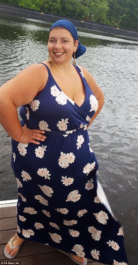Secret Snacker Who Hid Cakes Under Her Rolls Of Fat Loses 175lbs After Gastric Bypass Daily