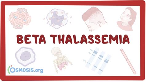 Beta Thalassemia Causes Symptoms Diagnosis Treatment Pathology