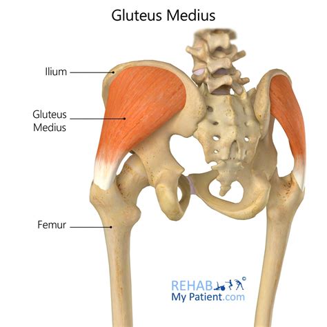 Gluteus Medius The Neglected One Mri Sumer S Radiology Blog My XXX
