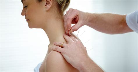 Acupuncture For Chronic Pain Can Acupuncture Help Relieve Pain