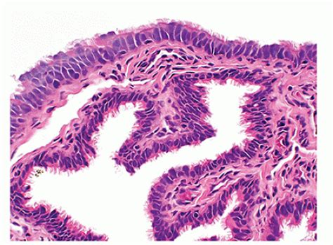 Fallopian Tube And Paratubal Region Basicmedical Key