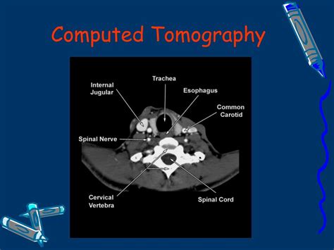 Ppt Radiographic Anatomy Of The Skeletal Powerpoint Presentation
