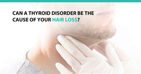 Can A Thyroid Disorder Be The Cause Of Your Hair Loss Advanced