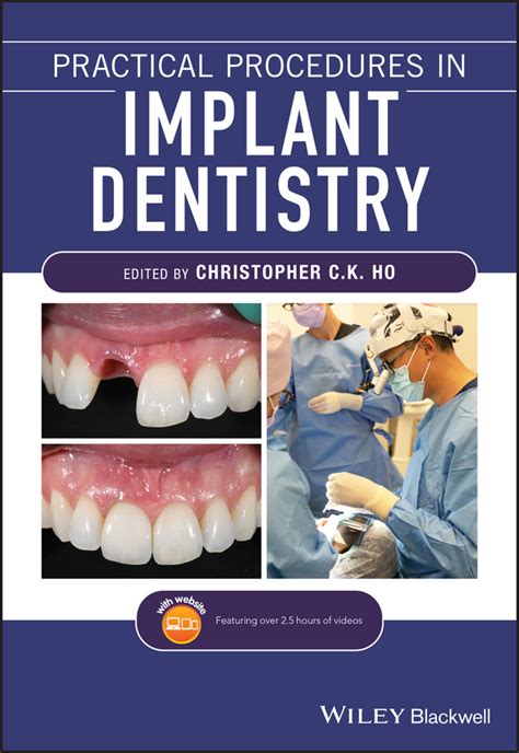 Practical Procedures In Implant Dentistry Read Online At Litres
