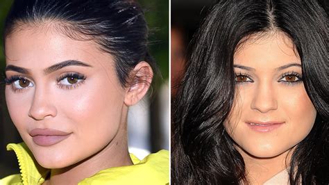 Kylie Jenners Krasse Beauty Transformation