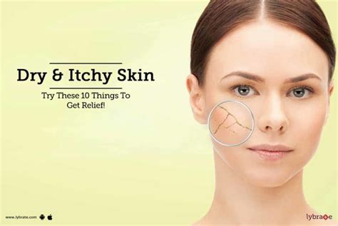 Dry And Itchy Skin Try These 10 Things To Get Relief By Dr Vivek