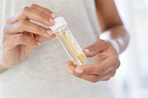 Urine Testing For Sexually Transmitted Infections Stis