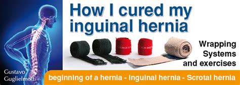 Shut Inguinal Hernia Without Surgery Exercises To Strengthen The