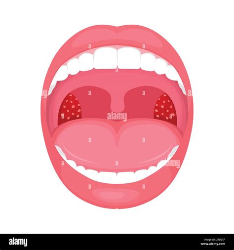 Strep A Medicine Stock Vector Images Alamy