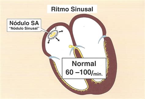 O Que é Ritmo Sinusal