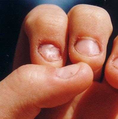 Maybe you would like to learn more about one of these? How to Read Fingernails based on their Shape