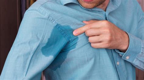 When Excessive Sweating Becomes A Medical Condition About