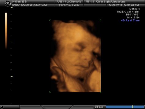 Erika Brent Sage And Zoo 4d Ultrasound 31 Weeks