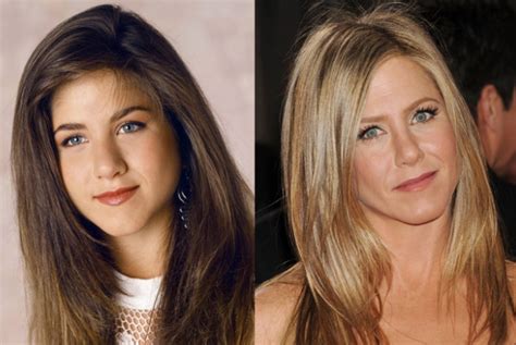 Jennifer Aniston Nose Job Surgery Before And After Photos
