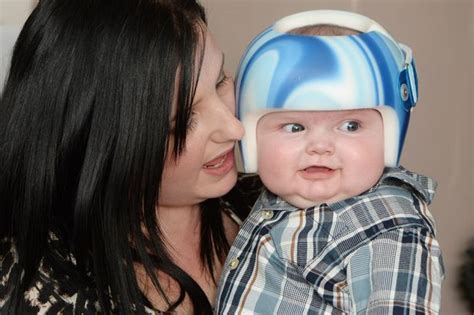 Mum Tells How Special Helmet Has Helped Her Baby Overcome Flat Head