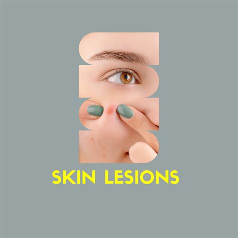 Skin Lesions Types Causes And Treatment For Skin1right