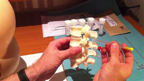 Lumbar Puncture Series Lumbar Spine Anatomy And Needle Trajectory