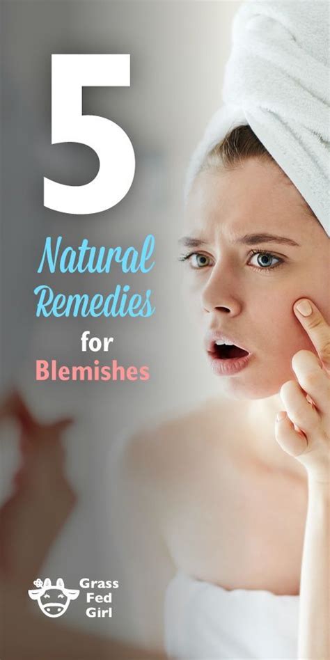 5 Natural Remedies For Blemishes Skin Cream Home Remedies For Skin
