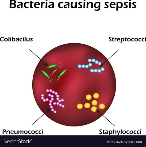 Sepsis Blood Poisoning E Coli Streptococci Vector Image