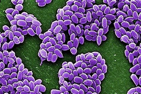 Us Military Accidentally Sends Live Anthrax To Lab Flickr