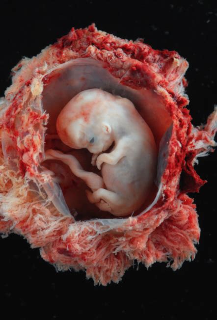 Conservative Musings Wonderful Pictures Of Embryos