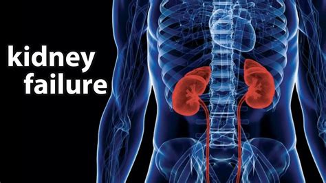 What Is Kidney Failure Cause Symptoms Treatments