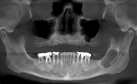Com Dec 2009 Diagnosis Uw School Of Dentistry