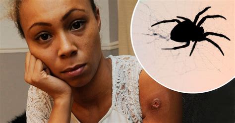 Horrific Spider Bite Leaves British Woman Paralysed Mirror Online