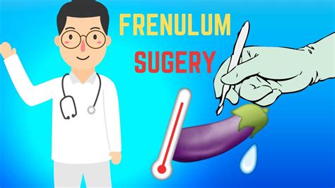 Frenuloplasty Short Frenulum Surgical Treatment Youtube