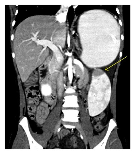 Ct Scan With Oral And Intravenous Contrast Ct Scanogram A Axial Ct