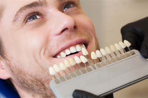 Professional Tooth Whitening Landmark Dental Group