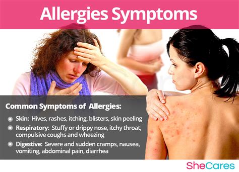 Allergies Allergic Reactions Shecares
