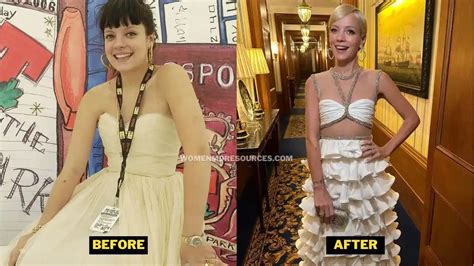 Lily Allen Weight Loss 2023 Diet And Glastonbury Event