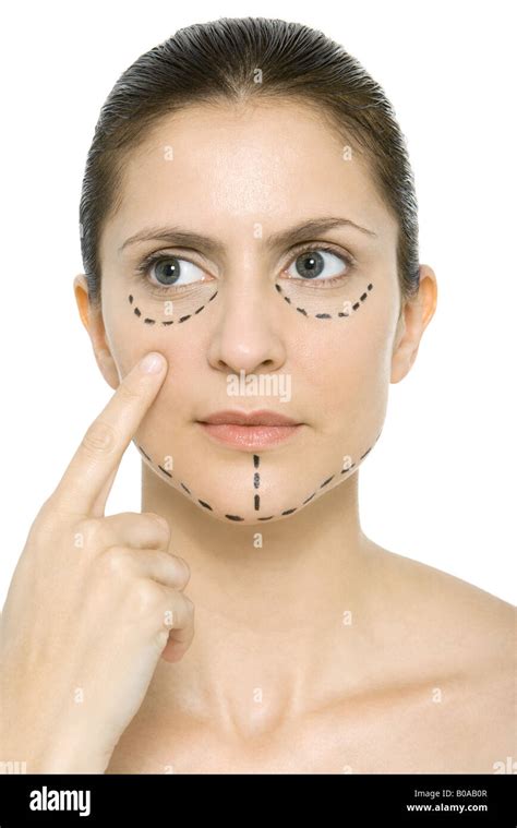 Woman With Plastic Surgery Markings On Face Pointing At Cheek Looking
