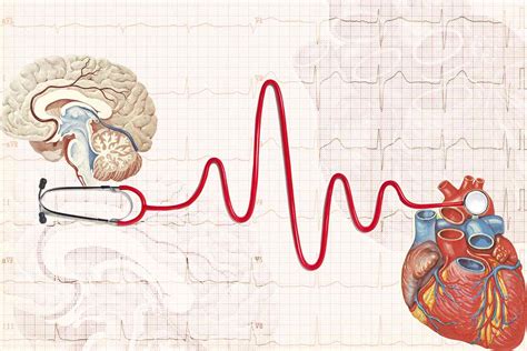 Heart Complications After Stroke Increase Risk Of Heart Attack Death
