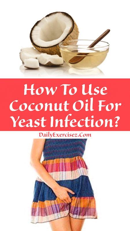 How To Use Coconut Oil For Yeast Infection Health Coconut Oil