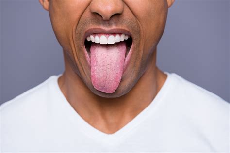Severely Swollen Tongues Are Affecting Some Covid Patients
