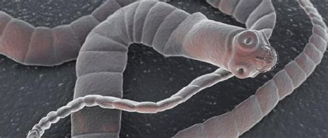 10 Most Dangerous Worms And Parasites That Can Live Inside You And Do