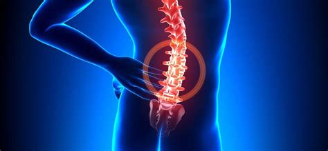 Kebanyakan kes sakit belakang selalunya tidak serius dan tidak memerlukan rawatan. Kelainan Kelengkungan Tulang Belakang - Penyebab dan Tipe ...