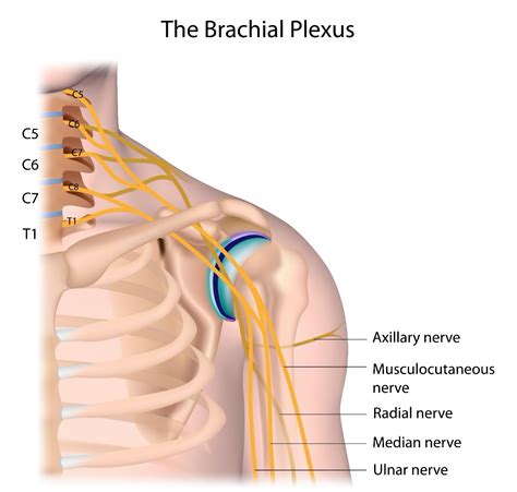 Brachial Plexus Injury Reeve Foundation