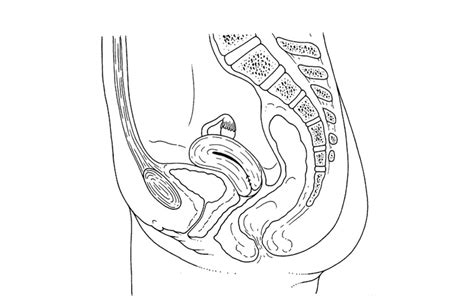 Female Pelvic Organs Diagram Quizlet