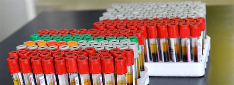 Chemical Pathology Clinical Biochemistry Pathology Services Our