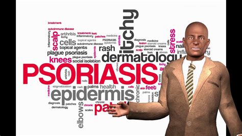 Is Psoriasis Curable The Real Facts Youtube