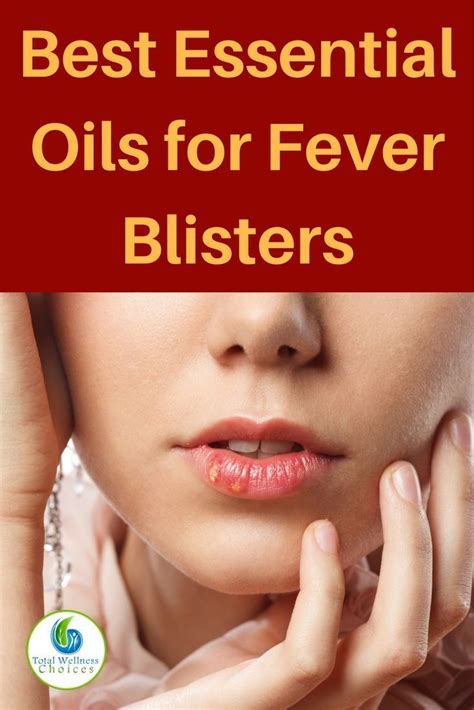 Top 5 Essential Oils For Fever Blisters Cold Sores Essential Oils